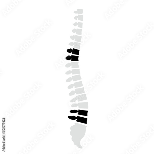 Spinal fracture vector illustration