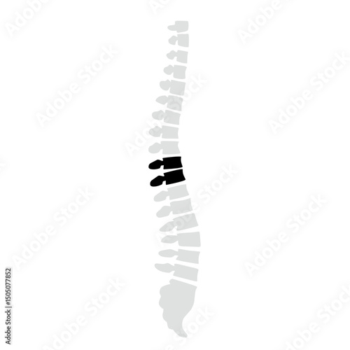 Spinal fracture vector illustration