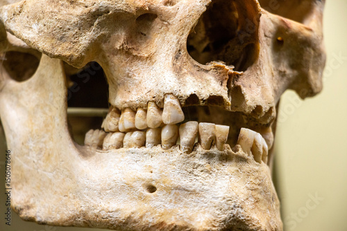 Human jaw and bone, teeth of the skull