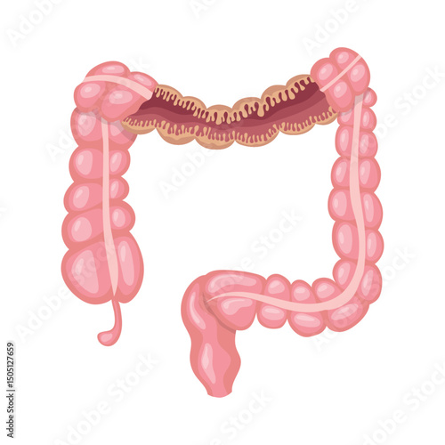 Large intestine showing its internal structure, including the appendix