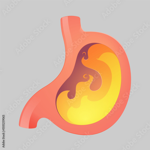 Acid reflux or heartburn