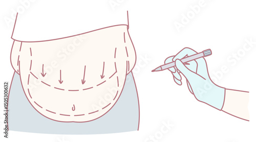 A meticulously handdrawn illustration showcasing various abdomen contouring techniques and procedures