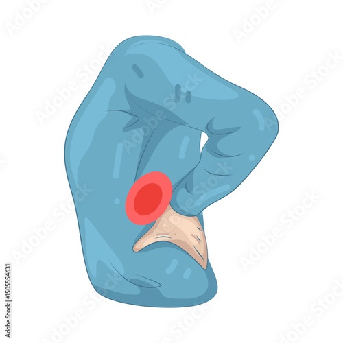 Illustration of Back Pain