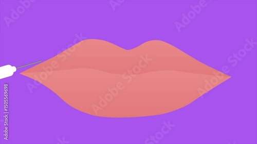 Filler injections in the lips. Animation 2D