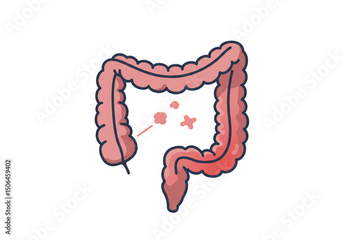 pink colon with cancer cells on white background clip art preview