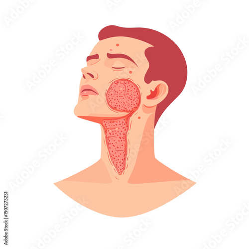 Man with Red Rash on Face and Neck Illustration Depicting Skin Condition Health Problem in a Clean Detailed Image