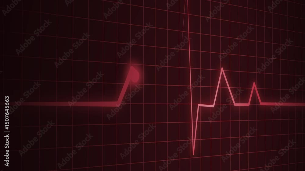 ECG Heartbeat Line on Grid Background, Electrocardiogram ECG Line ...