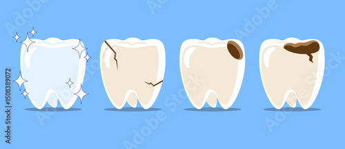 Healthy teeth, Cracked tooth, dental caries or tooth decayed . Set of flat design cartoon illustration . Isolated on Blue background . Vector .
