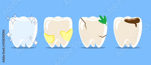 Healthy teeth, dental plaque, cracked tooth with food stuck, dental caries or tooth decayed . Set of flat design cartoon illustration . Isolated on Blue background . Vector .