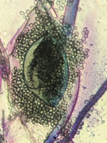 Canvas Print Aspergillus fungus structure under compound light microscop