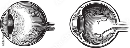 Two stylized illustrations depict cross-sections of human eyes showcasing intricate internal structures.