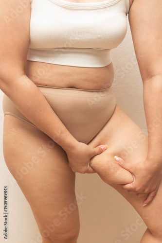 Woman standing and grabbing her inner thigh fat, highlighting natural body curves, cellulite