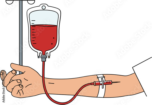 Blood transfusion process with bag and patient's arm on IV stand  