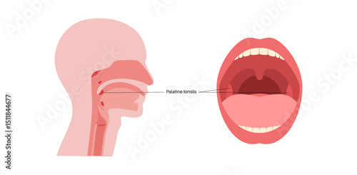 Palatine tonsils poster