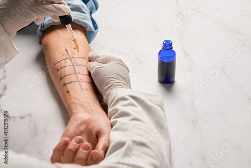 Immunologist Doing Skin Prick Allergy Test on a man's Arm