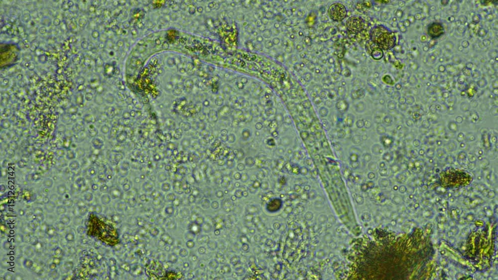 microorganisms and soil biology, with nematodes and fungi under the microscope. in a soil and compost sample microorganisms and soil biology, with nematodes and fungi under the microscope. in a soil and compost sample