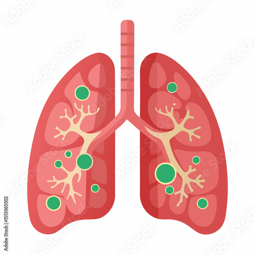 World Bronchiectasis Day Vector Illustration – Lung Disease Awareness, Respiratory Health, Medical Education