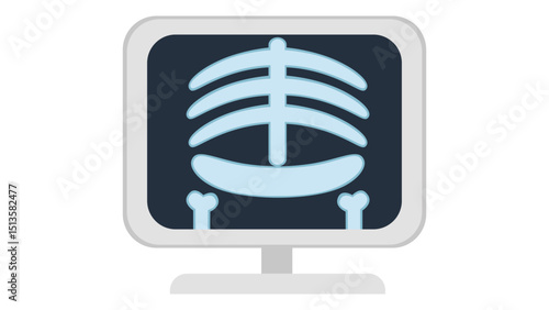 Chest X-Ray Medical Image