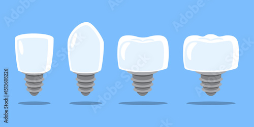 Dental implant . Type of teeth include incisor, canine, premolar and molar . Tooth cartoon illustration . Isolated on blue background . Flat design . Vector .