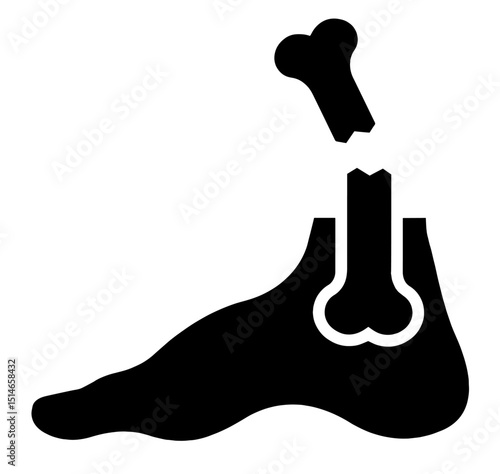 Broken Foot Bone – Fracture Injury, Medical Diagnosis, Orthopedic Trauma, Emergency Visualization, Healthcare Illustration, Clinical Anatomy