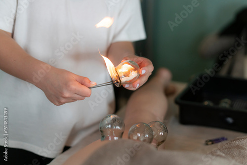 A practitioner prepares for a massage treatment by heating glass cups with a flame
