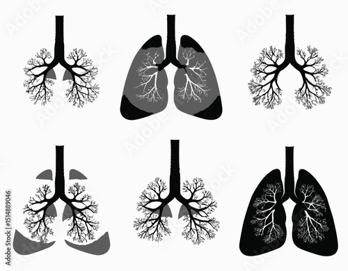 Gray Scale Medical Illustration Of Human Lungs Anatomy Showing Bronchi And