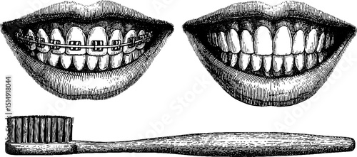 Engraved illustration set of dental braces and retainers for orthodontic care