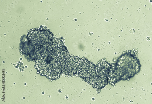 Spheroids of glioblastoma cell culture.