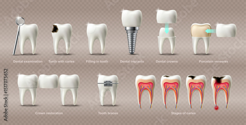 Medicine and healthcare in clinic, teeth care and treatment
