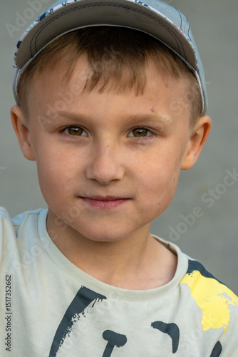 Wallpaper Mural Portrait of a young boy with scar on his face. High quality photo Torontodigital.ca