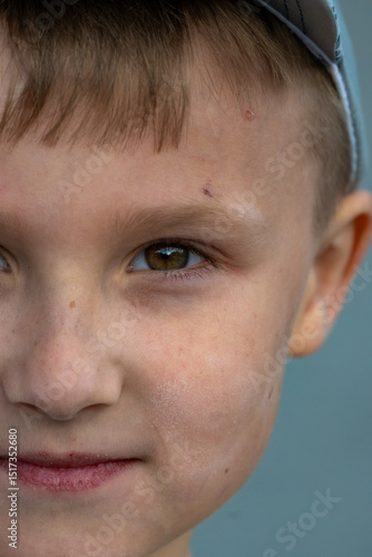 Wallpaper Mural Portrait of a young boy with scar on his face. High quality photo Torontodigital.ca