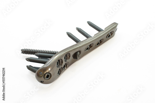 A surgical implant Proximal Femur titatium plate with screws for bone fixation, designed for stability and support