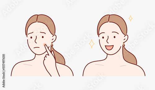 Girl with skin problem before and after. Vector illustration in cartoon korean style.