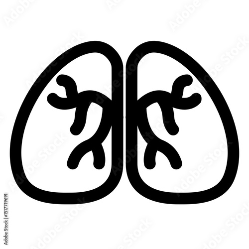 The image is a close-up of two lungs, each with a network of veins and arteries visible