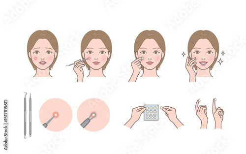 A cute woman character who extracts and removes whitehead, zit, acne with pimple potter tool and trouble patch