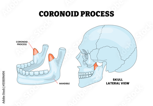 Coronoid Process in Human Skull Head Anatomy Structure Diagram with Lateral View, Educational Medical Poster Design Healthcare Scheme, Labeled Mandible, Condylar, Jaw, Cranial Bone.