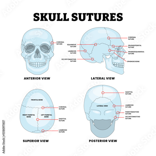 Different Types of Skull Sutures with Anterior, Posterior, Lateral, Superior View, Educational Medical Poster Design Healthcare Scheme, cavity, sagittal, lambdoid, parietomastoid, occipitomastoid.