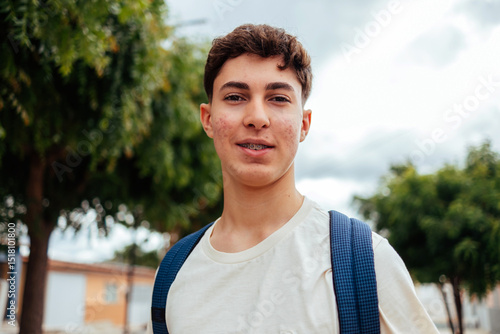 Teenage boy with braces and acne smiling outdoors, wearing a backpack and casual white t-shirt