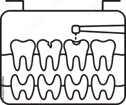 panoramic dental x-ray illustration