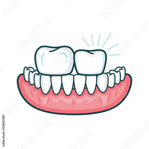 Illustration of Dentures with a Sparkling Tooth