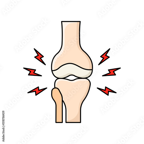 Arthritis disease illustration