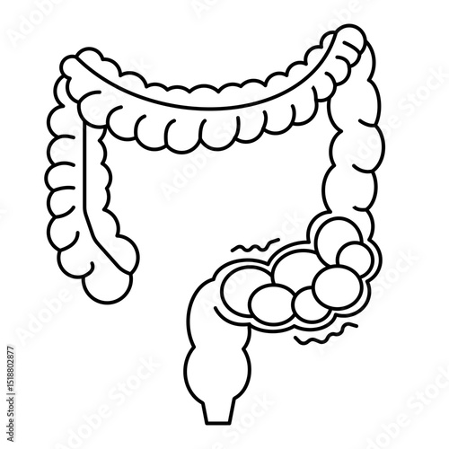 colon constipation