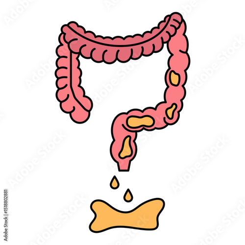 diarrhea disease illustration