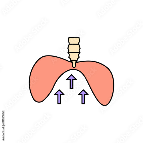 Diaphragmatic Spasm disease illustration