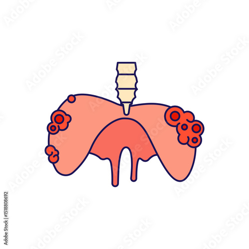 Diaphragmatic Tumor disease illustration