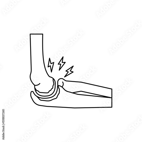 Elbow arthritis disease