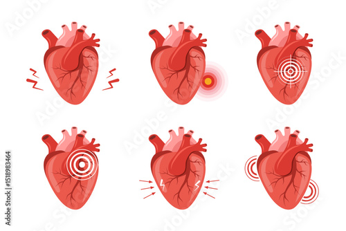 Heart pain. Human internal organ disease. Heart medical diagnosis and treatment. Set of Vector illustrations in flat cartoon style.