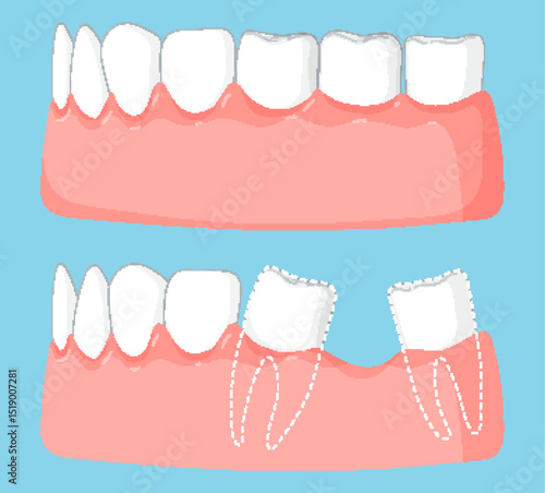 Dental Health and Tooth Extraction Illustration