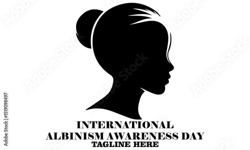 International albinism awareness day vector Illustration. International albinism awareness day logo design with white background