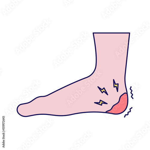 Plantar Fascilitis